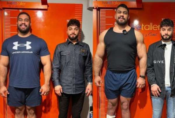 Hombre gast&oacute; casi USD 100 mil en cirug&iacute;as para aumentar de estatura