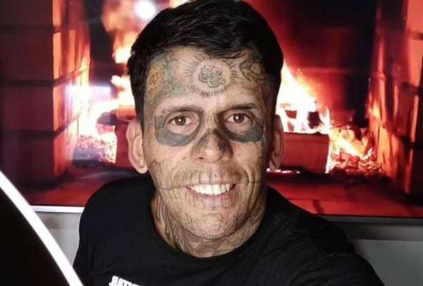 Leandro de Souza, el hombre m&aacute;s tatuado de Brasil se quit&oacute; los tatuajes de su rostro y cuerpo.