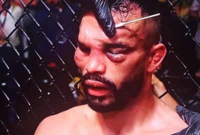 El rostro de Rob Font qued&oacute; afectado por la superioridad del Chito Vera