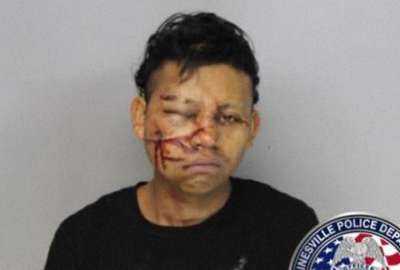 Un ladr&oacute;n cae en la huida de un robo y se desfigura el rostro en Estados Unidos