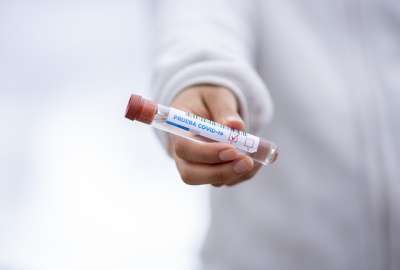 Sublinaje de coronavirus circula en Ecuador