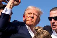 En una entrevista con el New York Post, el precandidato republicano Donald Trump detalló que perdió un pedazo de oreja y sufrió otras heridas tras el atentado del pasado sábado.