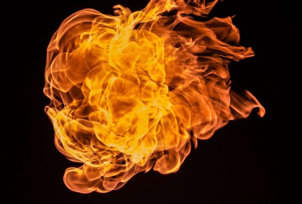 Niño sufre graves quemaduras en un evento escolar en Argentina