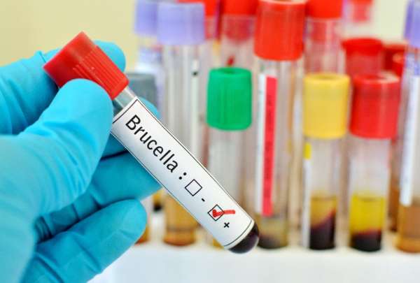 La brucelosis es causada por la bacteria 'Brucela', que infecta en su mayor&iacute;a al ganado. 