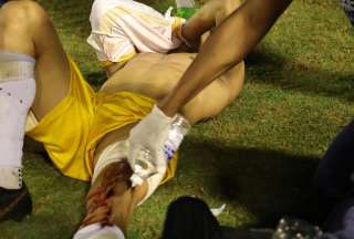 Brasil: Polic&iacute;a dispar&oacute; a jugador despu&eacute;s del partido