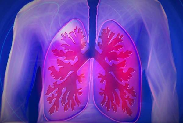 Vacuna terap&eacute;utica contra el c&aacute;ncer de pulm&oacute;n se abre paso en Estados Unidos