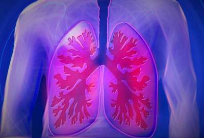 Vacuna terap&eacute;utica contra el c&aacute;ncer de pulm&oacute;n se abre paso en Estados Unidos