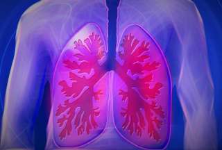 Vacuna terap&eacute;utica contra el c&aacute;ncer de pulm&oacute;n se abre paso en Estados Unidos