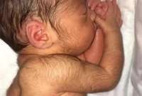 Una investigaci&oacute;n en Espa&ntilde;a revel&oacute; por qu&eacute; los beb&eacute;s nacen con este s&iacute;ndrome. 