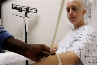 Nuevo estudio sugiere una nueva epidemia mundial de c&aacute;ncer entre menores de 50 a&ntilde;os