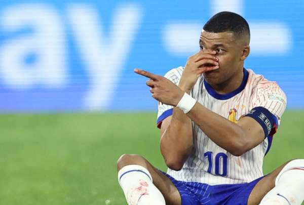 Mbapp&eacute; se rompi&oacute; la nariz en la Eurocopa