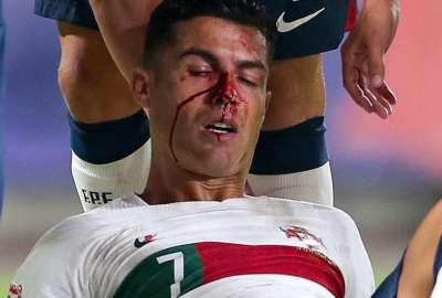 Cristiano Ronaldo casi termina con la nariz rota en el duelo contra Rep&uacute;blica Checa. 