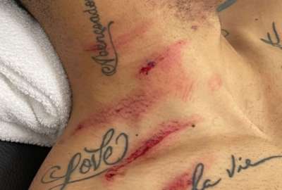 Matheus Cunha mand&oacute; un mensaje luego de las huellas que le dej&oacute; Dom&iacute;nguez en su cuello