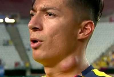 Alan Franco se someti&oacute; a un drenaje del quiste en su cuello