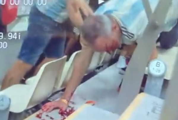 Un hincha argentino termin&oacute; con sangre en el rostro, tras incidente con los mexicanos en el estadio de Lusail.