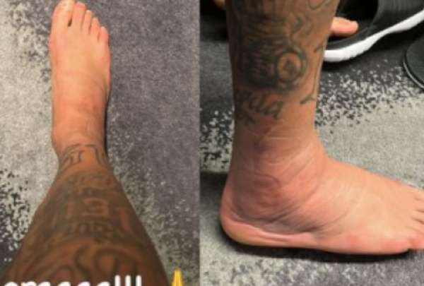 Neymar termin&oacute; con el tobillo hinchado, tras el duelo contra Serbia. 
