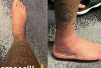 Neymar termin&oacute; con el tobillo hinchado, tras el duelo contra Serbia. 