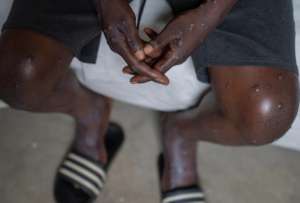 La letal variante clado 1b de viruela s&iacute;mica no ha registrado casos en Ecuador.