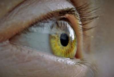 Joven se provoca una infecci&oacute;n en los ojos por someterse a un procedimiento en las pesta&ntilde;as
