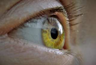 Joven se provoca una infecci&oacute;n en los ojos por someterse a un procedimiento en las pesta&ntilde;as