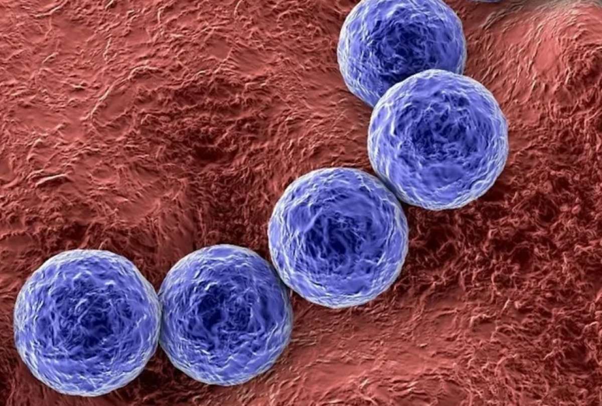 En los últimos seis meses en Argentina, el número de infecciones ha crecido por la bacteria; también los fallecidos.