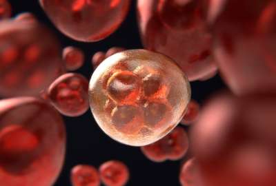 As&iacute; puedes reconocer el c&aacute;ncer en sus etapas tempranas
