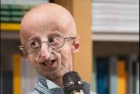 El cient&iacute;fico italiano dedic&oacute; su vida a la investigaci&oacute;n y concienciaci&oacute;n sobre la enfermedad.