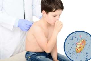 &iquest;C&oacute;mo prevenir la tosferina?