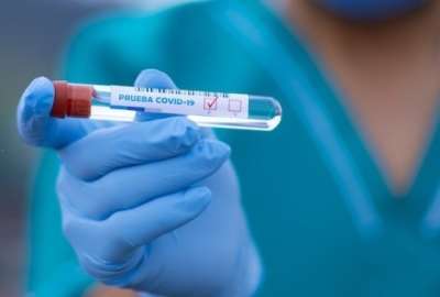 Modelo matem&aacute;tico revela subregistro de casos de covid-19 en el mundo