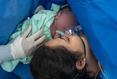 La vida de un beb&eacute; se salv&oacute; gracias a la intervenci&oacute;n de los especialistas del Hospital Monte Sina&iacute;. 