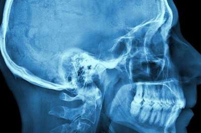 Cient&iacute;ficos identifican nueva parte del cuerpo esencial para masticar