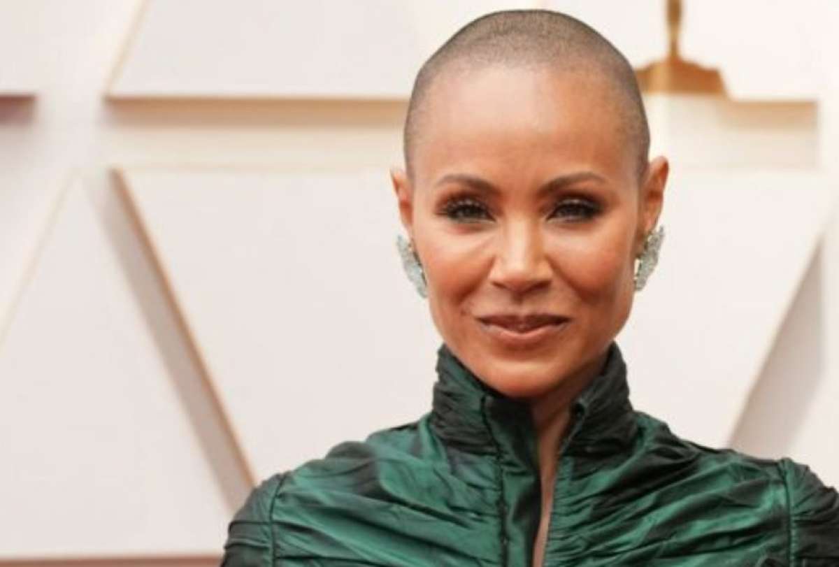 Premios Oscar 2022: Jada Pinkett Smith y su lucha contra la alopecia