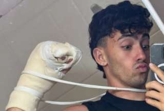 El influencer argentino Gero Arias protagoniz&oacute; un escalofriante escena que fue transmitida a trav&eacute;s de sus redes sociales
