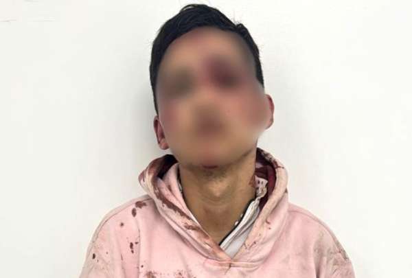 Dos presuntos antisociales fueron abatidos por la Polic&iacute;a Nacional. Otro m&aacute;s fue detenido.