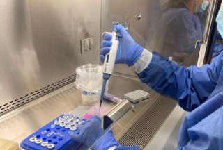 El virus de la viruela del mono se detecta con frecuencia en la saliva y en el semen