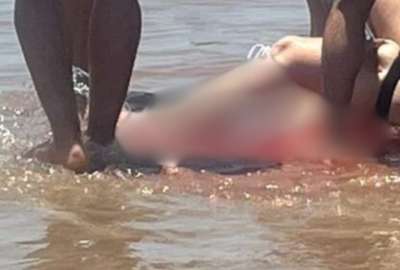 Una mujer result&oacute; herida en su pantorrilla por un ataque de tibur&oacute;n en la isla del Padre.