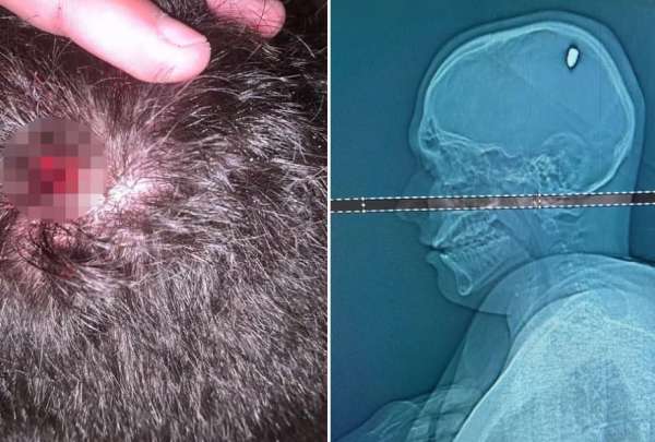 Joven pas&oacute; cuatro d&iacute;as con una bala en su cabeza sin saberlo