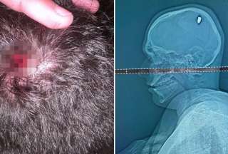 Joven pas&oacute; cuatro d&iacute;as con una bala en su cabeza sin saberlo