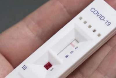 Las pruebas r&aacute;pidas de covid-19 ser&aacute;n de venta libre en el Ecuador. 