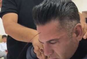 Un hombre se saca sangre de su frente para supuestamente aliviar los dolores de cabeza.