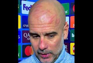 Pep Guardiola apareci&oacute; con rasgu&ntilde;os en la nariz y la cabeza