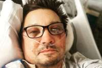 Jeremy Renner permaneció dos semanas en el hospital, tras ser atropellado por su quitanieves en víspera de año nuevo.