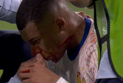 Mbapp&eacute; se lesion&oacute; en el debut de la Eurocopa