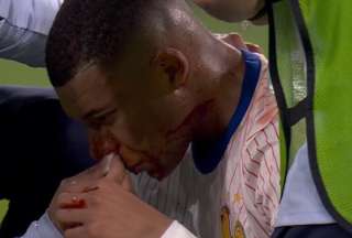 Eurocopa: Alarmas encendidas por la lesi&oacute;n de Kylian Mbapp&eacute;