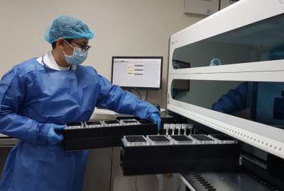 Las muestras que se procesar&aacute;n para la detecci&oacute;n del c&aacute;ncer de cuello uterino en el hospital de Cuenca provienen de nueve casas de salud de Ecuador. 