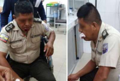 Polic&iacute;a recibi&oacute; impacto de camareta en su rostro