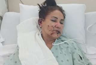Una mujer fue brutalmente atacada por los perros de sus due&ntilde;os de casa