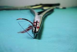 Primera operaci&oacute;n de rodilla realizada por un robot en China