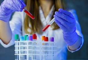 Hemgenix, el medicamento gen&eacute;tico m&aacute;s caro del mundo