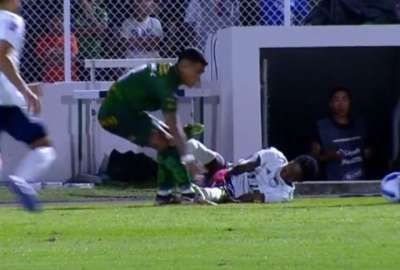 Jackson Rodr&iacute;guez sufri&oacute; una dura lesi&oacute;n en el partido de Orense ante Emelec